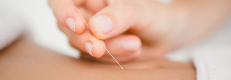 acupuncture common myths