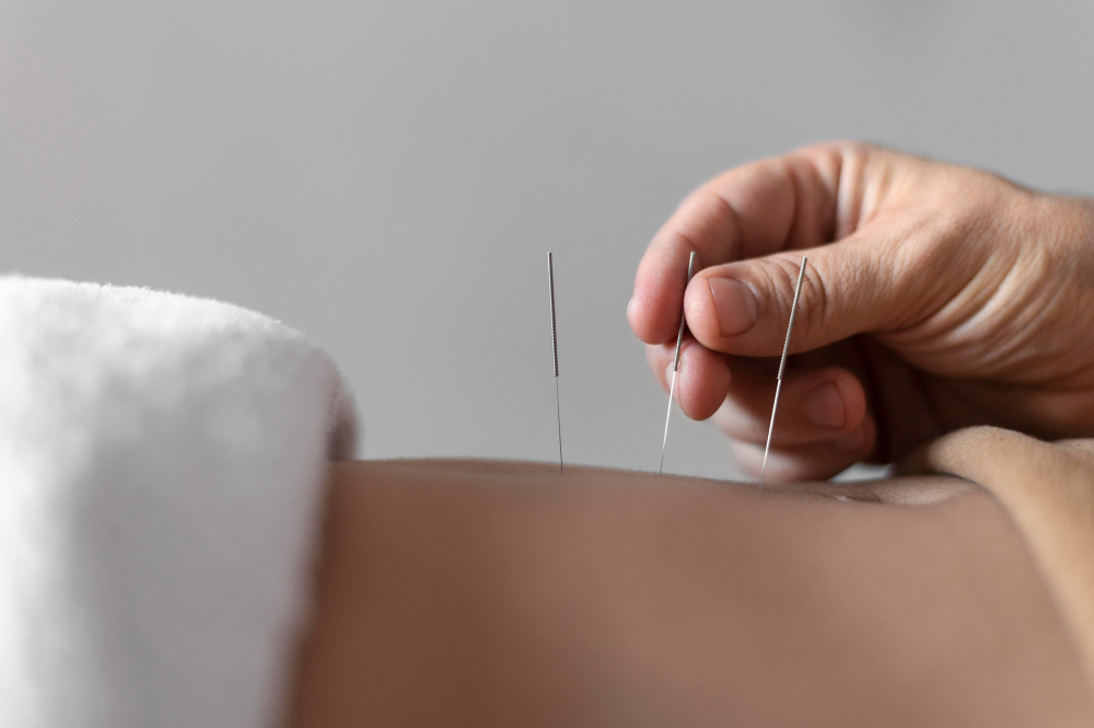 acupuncture for fertility in Madison